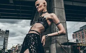 Meet Melanie Gaydos, 28-Year-Old Model With A Rare Genetic Disorder Who Broke All Fashion Stereotypes