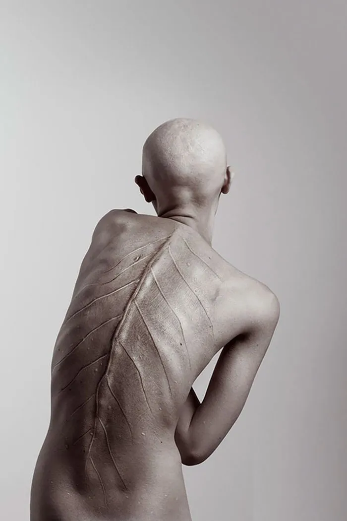 Meet Melanie Gaydos, 28-Year-Old Model With A Rare Genetic Disorder Who Broke All Fashion Stereotypes