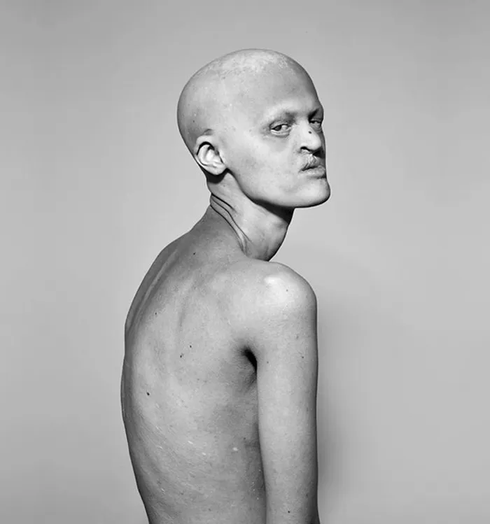 Esta es Melanie Gaydos, una modelo de 28 años con un raro trastorno genético que ha roto los estereotipos de la moda