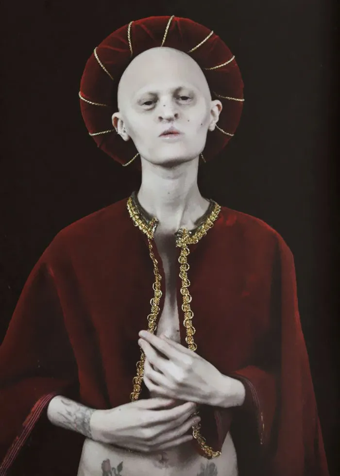 Meet Melanie Gaydos, 28-Year-Old Model With A Rare Genetic Disorder Who Broke All Fashion Stereotypes