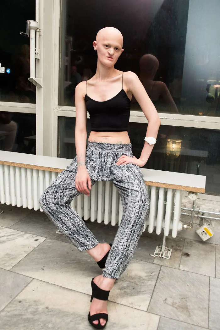 Meet Melanie Gaydos, The Model Who Broke All Fashion Stereotypes