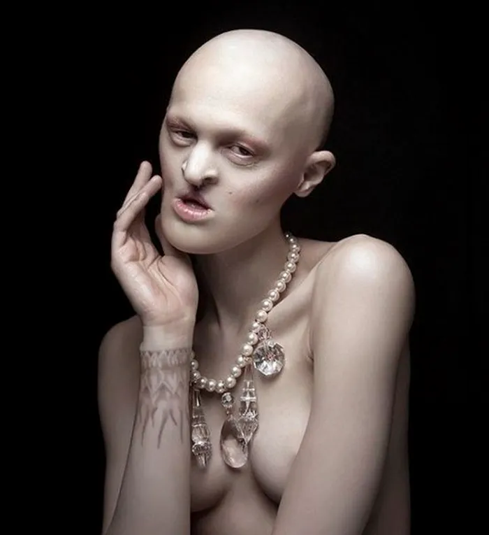 Meet Melanie Gaydos, 28-Year-Old Model With A Rare Genetic Disorder Who Broke All Fashion Stereotypes