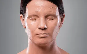 The Vitiligo Project