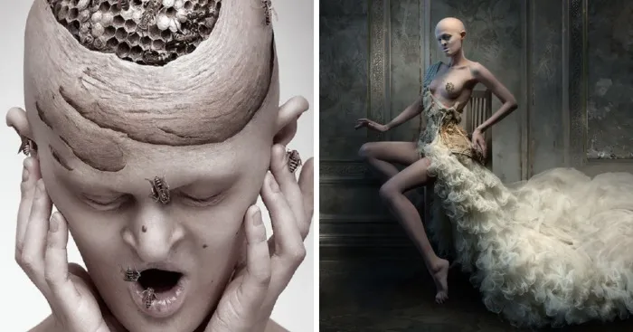 Meet Melanie Gaydos, 28-Year-Old Model With A Rare Genetic Disorder Who Broke All Fashion Stereotypes