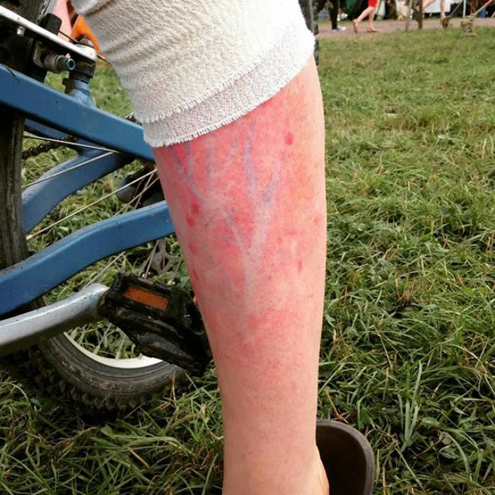 I Couldn't Help But Be Swept Away By The Stunning Cherry Blossom Like Image That Appeared On Her Leg