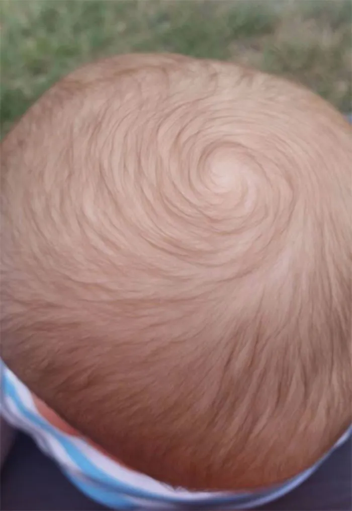 My 8 Month Old's Hair Is Always In A Perfect Swirl That Reminds Me Of A Van Gogh Painting