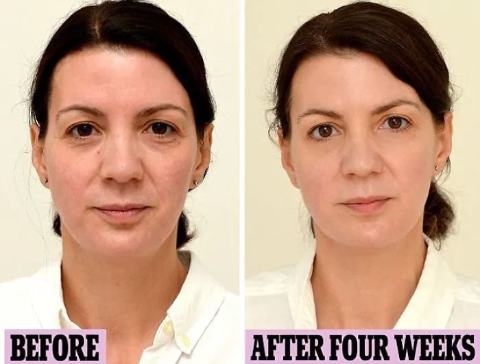 How Drinking 3 Liters Water A Day Changed My Face (That Will Inspire You To Get More Structured Face Cut)