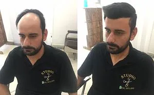 Share Before & After Pics Of Your Extreme Haircut Transformations