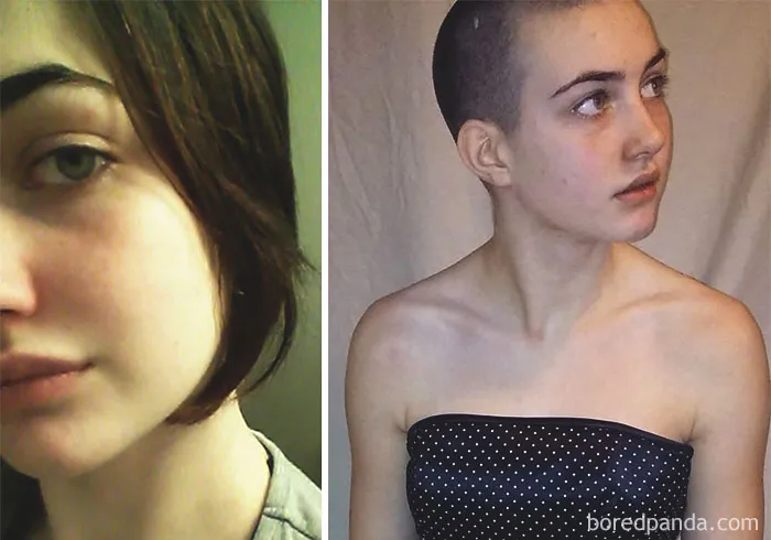 Before And After