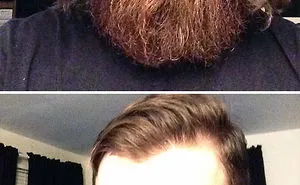 Share Before & After Pics Of Your Extreme Haircut Transformations