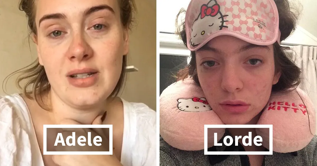 10+ Celebridades sin maquillaje que demuestran parecerse a cualquiera de nosotros