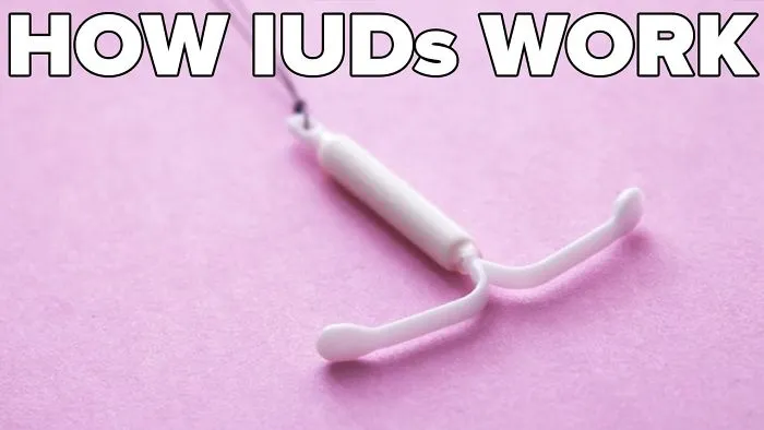 How Iuds Work