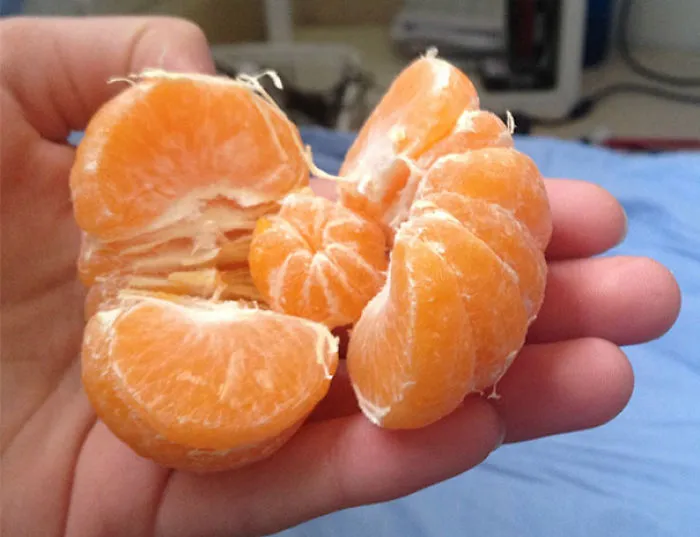 Minimandarina dentro de la mandarina