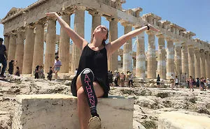 Girl Gets Herself A Chalkboard Leg For A Trip To Europe, And The World Falls In Love With Her