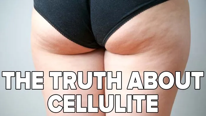 The Truth About Cellulite