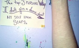 Three Reasons Why I Don't Give A Damn About My Self-Harm Scars