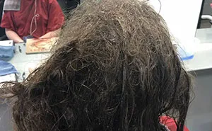 Hairdresser Refuses To Shave Depressed Teen's Hair, Spends 13 Hours Fixing It