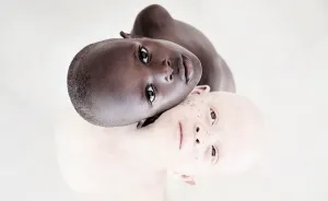 Stunning Photos Show The Beauty Of Albino Children To Raise Awareness Of Their Heartbreaking Situation In Tanzania
