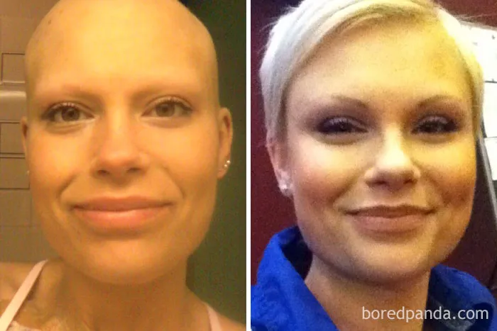 5 Years Cancer Free!!! Very Long Journey