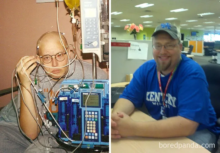In 1999 I Was Diagnosed With Stage 4b Burkitts Leukemia. I Had A 90% Chance Of Dying, So We (My Parents And I) Opted To Try An Experimental Chemotherapy Regiment. It Worked! Today I'm 14 Years Cancer Free