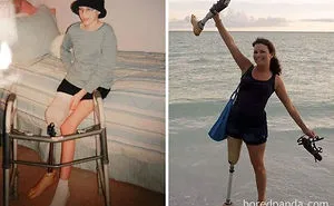 30 Incredible Before & After Pics Of People Who Beat Cancer That Will Make You Appreciate Life