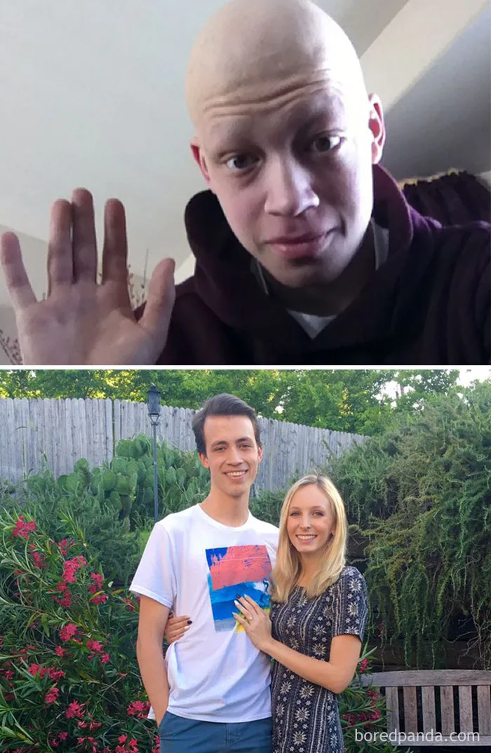 3 Years Cancer Free