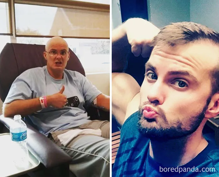 Me In Late 2013 When I Was Battling Cancer And Me Currently