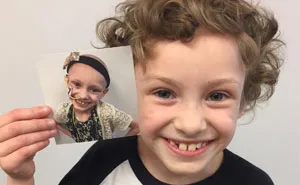 30 Incredible Before & After Pics Of People Who Beat Cancer That Will Make You Appreciate Life