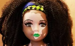 Artist Creates Dolls With Vitiligo For Kids With This Rare Skin Condition
