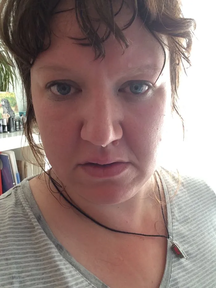 Woman in gray striped shirt, close-up expression, highlighting depression symptoms showing no distinct face.