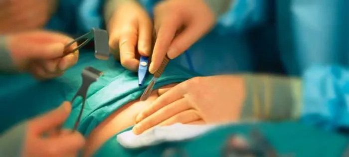 Piles Surgery Cost In Chennai