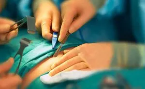 Piles Surgery Cost In Chennai