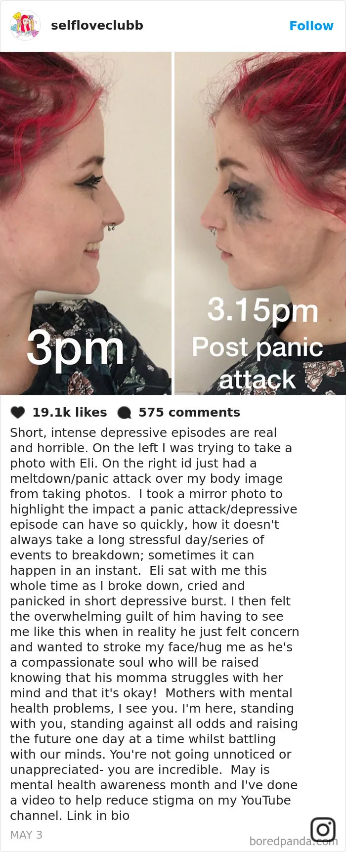 47 Photos That Prove Depression Symptoms Have No Face