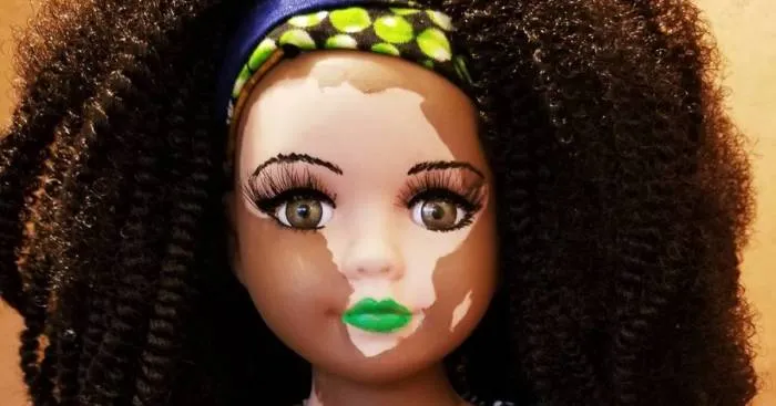 Artist Creates Dolls With Vitiligo For Kids With This Rare Skin Condition
