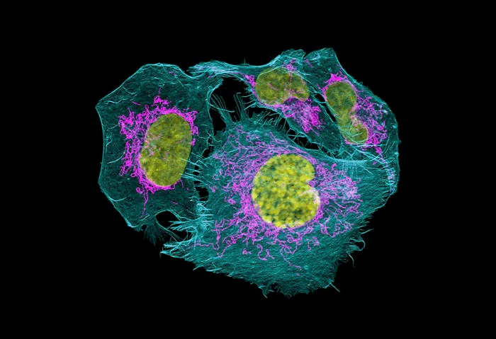Prostate Cancer Cells, Usa, Image Of Distinction