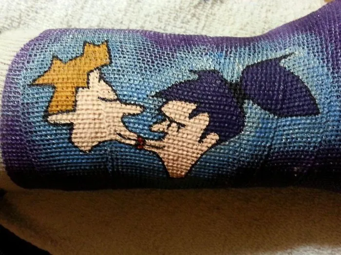 My Cast Comes Off Tomorrow, But I Am Almost Sad To Slough Off My Boyfriend's Painting