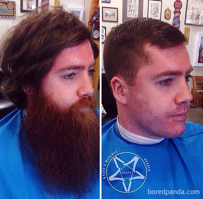 Before And After