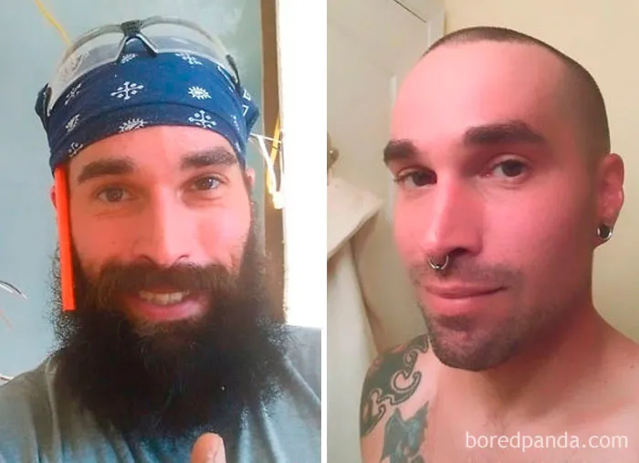Before And After