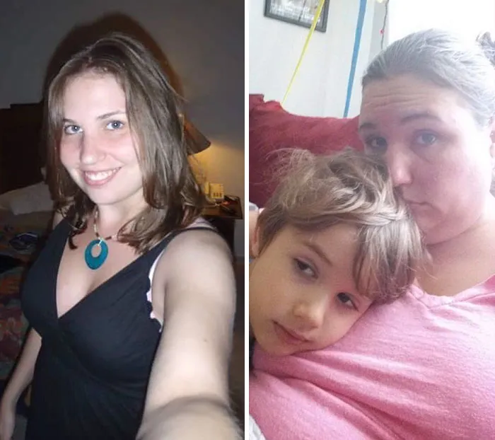 Got Todlerred: Parents Are Sharing Photos Of Them Before And After Having Kids, And The Difference Is Too Real