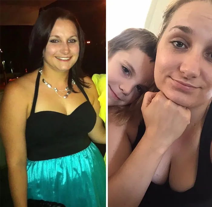 Got Todlerred: Parents Are Sharing Photos Of Them Before And After Having Kids, And The Difference Is Too Real