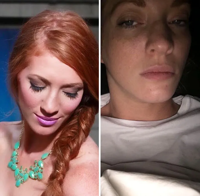 Got Todlerred: Parents Are Sharing Photos Of Them Before And After Having Kids, And The Difference Is Too Real
