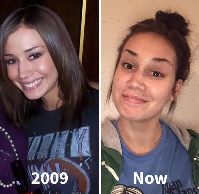 Got Todlerred: Parents Are Sharing Photos Of Them Before And After Having Kids, And The Difference Is Too Real