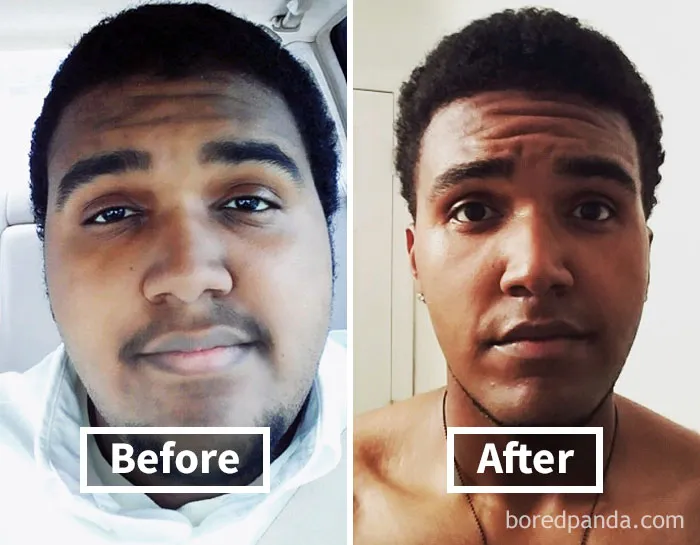 Before and after photos showing face fat loss results from weight loss.