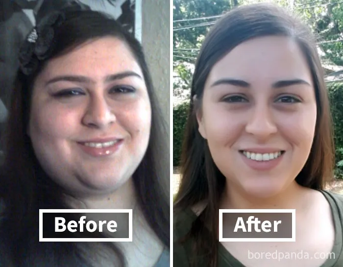 Face fat loss shown in before and after weight loss images of a smiling woman.