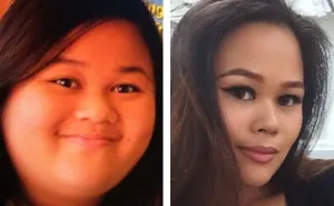 128 Surprising Photos of Face Fat Loss Before and After Weight Loss