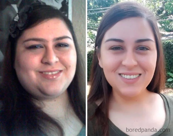 He perdido 45 kilos y me ha cambiado la cara