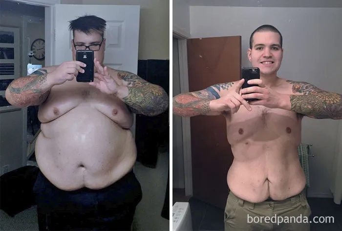 Tras perder 90 kilos