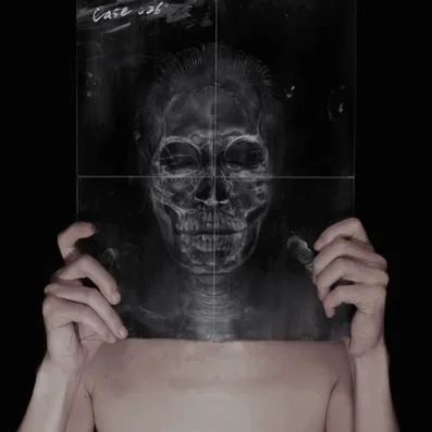 Amazing X-Ray Costume