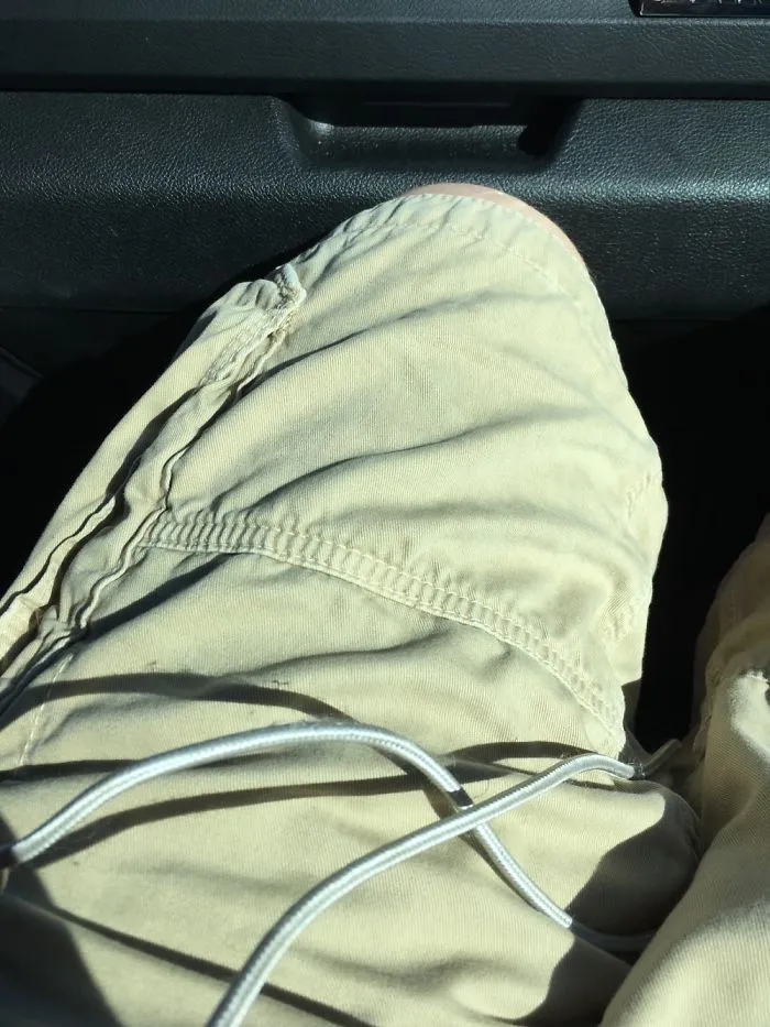 Leg