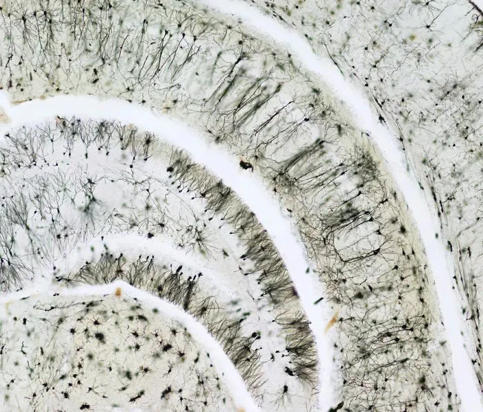 Hipocampo cerebral, California, imagen distinguida